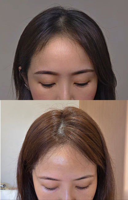 CrownLab Scalp Tonic 8 bottles