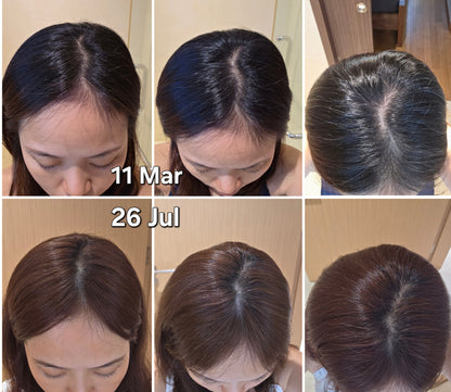 CrownLab scalp tonic 2 bottles